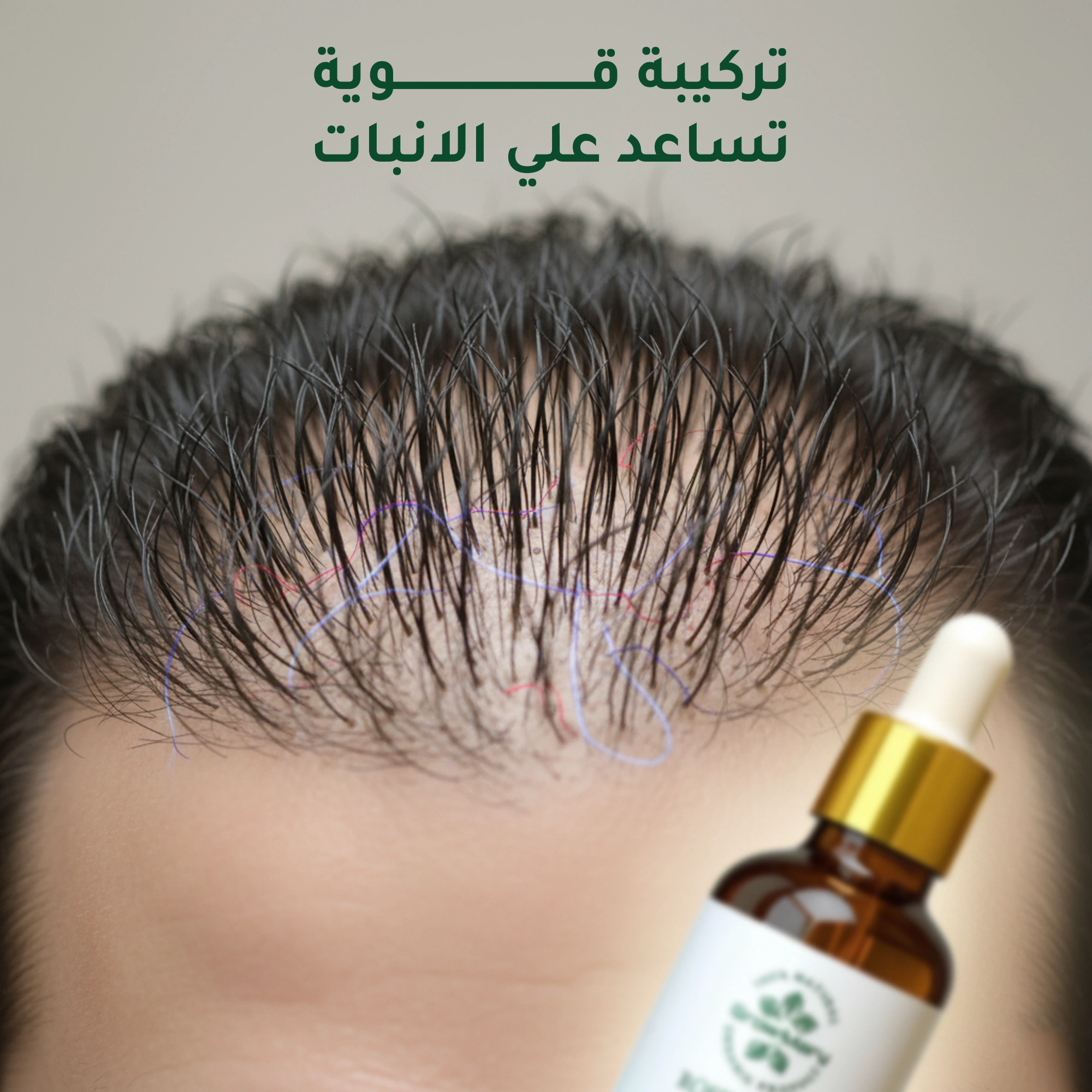 4ad0d2ce-662d-4207-8972-1c69803d2ba3.1- Product -1